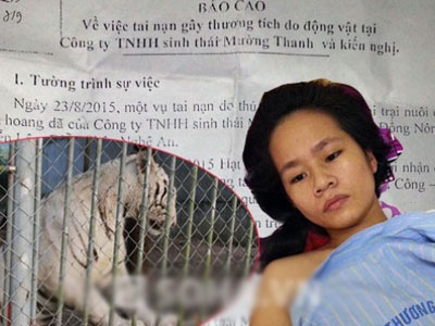 Thiếu nữ bị hổ vồ đứt cánh tay đã xuất viện