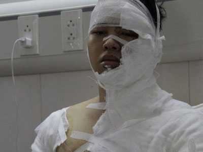 Nam sinh ĐH Sân khấu Điện ảnh bị "khủng bố" trước khi bị tạt axit