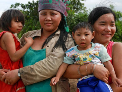 Nỗi lòng của người cha 2 chị em "giống khỉ"