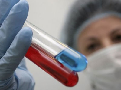 Phát hiện "siêu kháng thể" tiêu diệt virus HIV