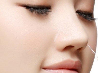 Phẫu thuật nâng mũi có thay đổi vận mệnh?