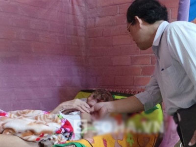 Thông tin chính thức về người bị "ăn" mòn nửa mặt ở Tiền Giang