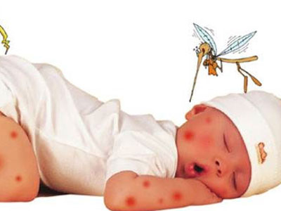 Biến chứng nguy hiểm khi coi thường sốt xuất huyết
