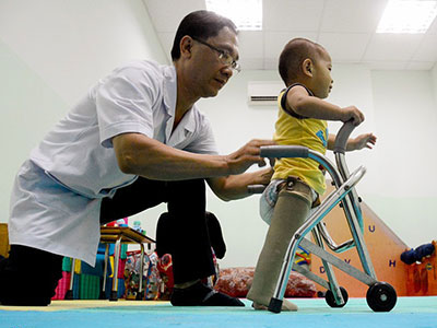 Em bé văng ra khỏi bụng mẹ tập đi bằng chân giả