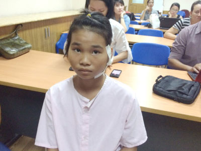 Bé gái 13 tuổi bị đạn súng hơi bắn trúng cổ