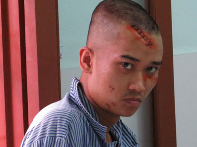 Con nghiện đâm dã man nhân viên nhà nghỉ lúc nửa đêm