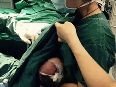 Nữ y tá vừa phẫu thuật vừa cho bú ngay trên bàn mổ