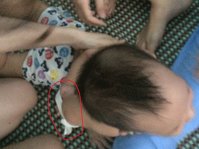 Cháu bé bị 3 giáo viên trói, nhét khăn vào miệng phải nhập viện