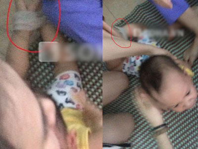 Kinh hoàng: Bé 15 tháng bị 3 giáo viên đánh, trói, nhét giẻ vào mồm