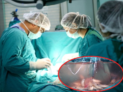 Kinh hãi giòi lúc nhúc trong đầu bệnh nhân