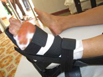 Cắt gân hàng xóm vì nghi trộm chó của gia đình