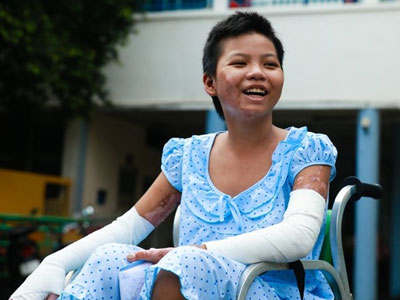 Nụ cười ngày xuất viện của bé gái bán vé số bị mẹ đốt