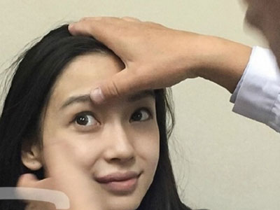 Lộ phim X-quang bị nghi có vật thể lạ trong mũi Angelababy