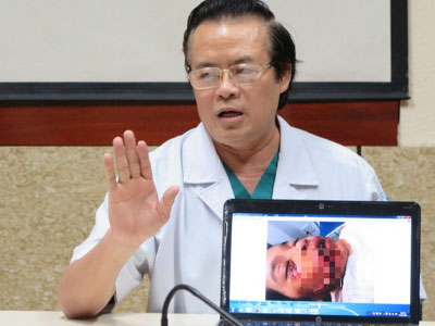 Bị chó cắn nát mặt, bé gái phải khâu 7,5 mét chỉ