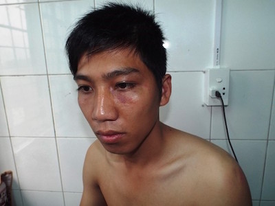 Công an huyện tiếp nhận đơn tố công an xã đánh dân gây thương tích tại trụ sở