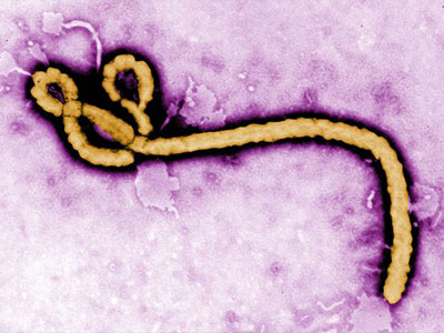 Người tham gia thử văcxin Ebola sẽ được trả 750 bảng Anh