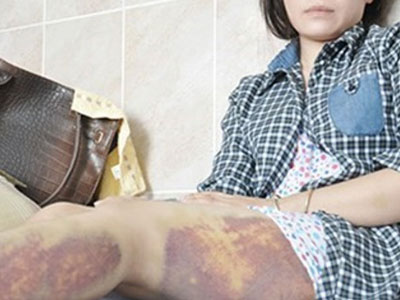 Công an Trảng Bàng xin lỗi nữ công nhân bị đánh nhập viện