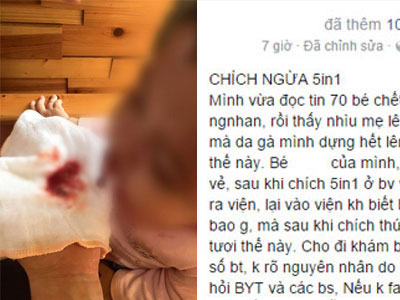 Ảnh bìa bài viết 326866