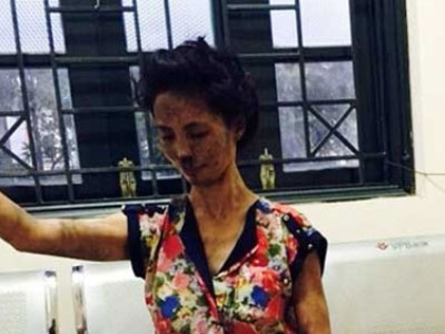 Ngáo đá, một phụ nữ tự đốt nhà rồi leo ra lan can gào thét