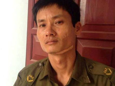 Say rượu chặn đường đánh người dân, dùng dao cứa cổ công an
