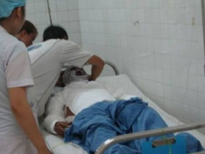 Nửa đêm, vợ tạt axit vào mặt chồng cũ rồi bỏ trốn