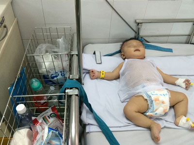 Bé trai bị đâm xuyên sọ nhập viện vì viêm màng não