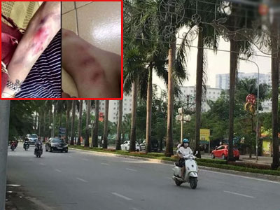 Hà Nội: Thực hư cô gái làm make-up bị cướp đánh trong đêm