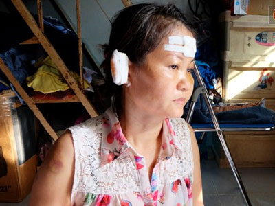 Nam sinh cầu cứu vì cả gia đình bị côn đồ hành hung liên tục hơn 2 năm