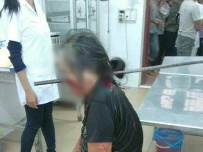 Phía sau bức ảnh cụ bà bị thanh sắt xuyên thủng đầu đang lan truyền trên mạng