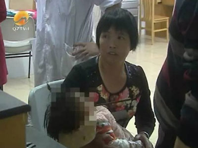 Bà ngoại bất cẩn, bé 1 tuổi nguy kịch vì bị đũa đâm xuyên miệng