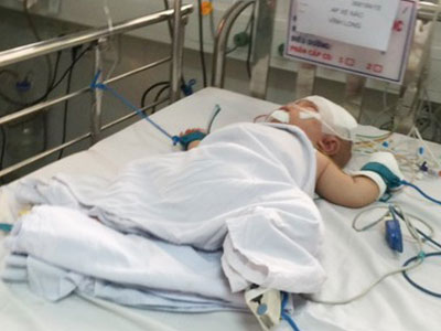 Bé trai bị dao đâm xuyên sọ hồi phục sau phẫu thuật lần 2