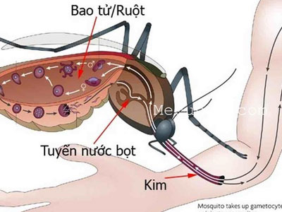 Sự thật sốt xuất huyết khiến người bệnh "ăn cơm thủng ruột"