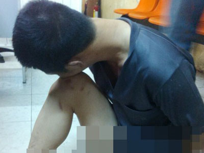 Màn giả điên của gã giang hồ tại trụ sở cảnh sát