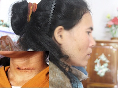 Bị chồng cắt cổ, vợ nín thở giả chết