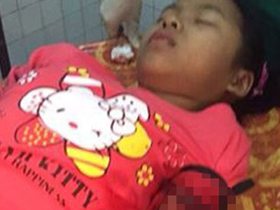 Bắt khẩn cấp 2 nghi can bịt mặt dùng dao đâm nữ sinh trong đêm