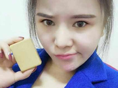 Bị đá vì béo, cô gái đã... hút mỡ làm xà phòng tặng bạn trai cũ