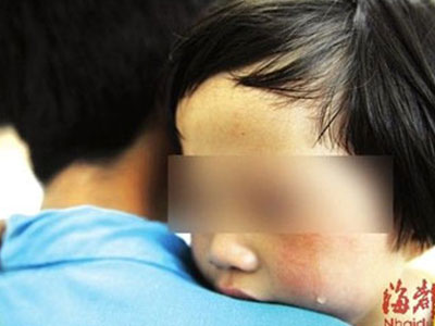Bé gái 3 tuổi bị bạn của cha mẹ hiếp dâm