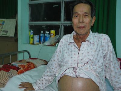 Diễn viên phim "Ván bài lật ngửa" qua đời