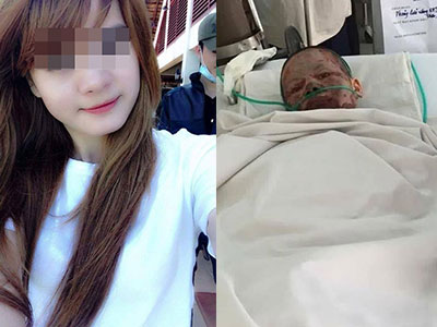 Cô gái xinh đẹp bỏng nặng do bị bạn trai tạt xăng đốt vừa qua đời