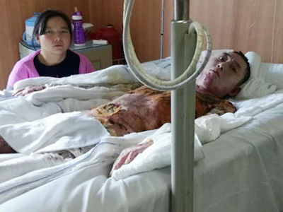 Công ty Trung Quốc gợi ý công nhân chết êm ái vì sợ tốn tiền viện phí