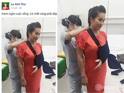 Bà xã Bình Minh bị tai nạn rạn nứt xương