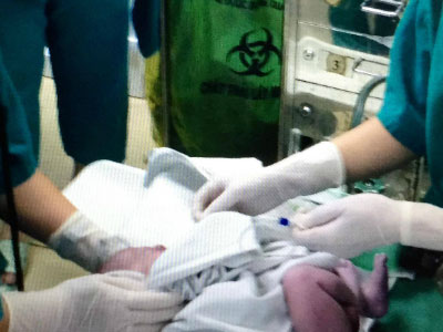 Ca mổ "cân não" cứu mẹ con thai phụ bị vỡ động mạch chủ