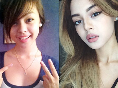 Hành trình thay đổi nhan sắc ngoạn mục của "hot girl môi tều" Lily Maymac