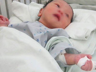 Mẹ cắn đứt ngón tay con gái 2 ngày tuổi để… trừ tà và "dễ nuôi"?