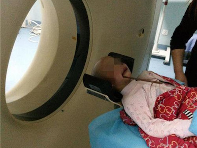 Bé gái 3 tuổi nguy kịch trong bữa cơm sum họp gia đình dịp Tết