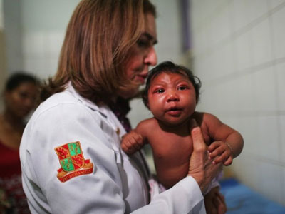 Không phải Zika mà hóa chất của Monsanto gây teo não?