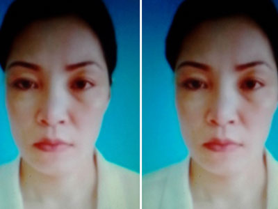 Chân dung nữ tử tù mua tinh trùng để tự thụ thai