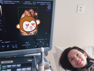 Bạn gái cũ Mạc Hồng Quân khoe ảnh siêu âm con trai