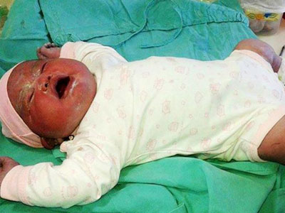 Bé sơ sinh nặng 6,3 kg chào đời ở Argentina