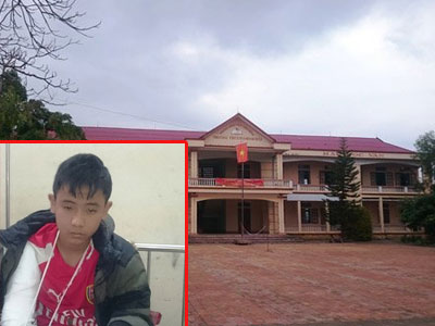 Thanh Hóa: Thầy giáo vụt rạn xương tay học sinh